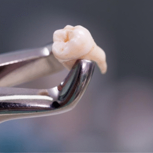 Fundamentos essenciais de exodontia: da teoria à Prática Clínica